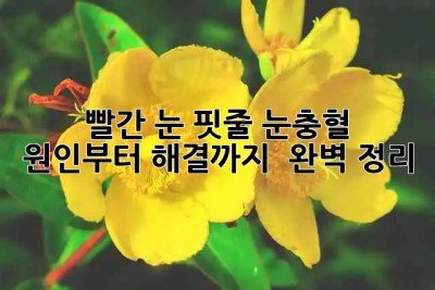 🚨 빨간 눈 핏줄? 눈충혈 원인부터 해결까지! 👀 완벽 정리